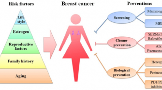 Some Of The Most Common Breast Cancer Risk Factors [ The List ]