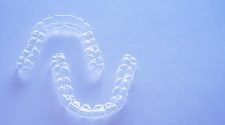 Know Why Transparent Tooth Clip is Ideal for Transforming Your Smile?